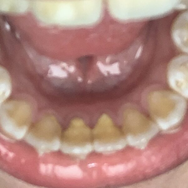 Brush Away Tartar & Plaque with Patented TartarEnd® Toothpaste