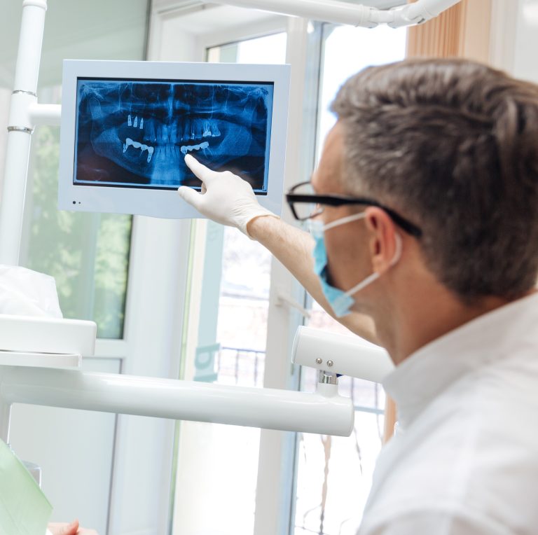 Remove Tartar, Plaque & Dental Calculus TartarEnd® Toothpaste