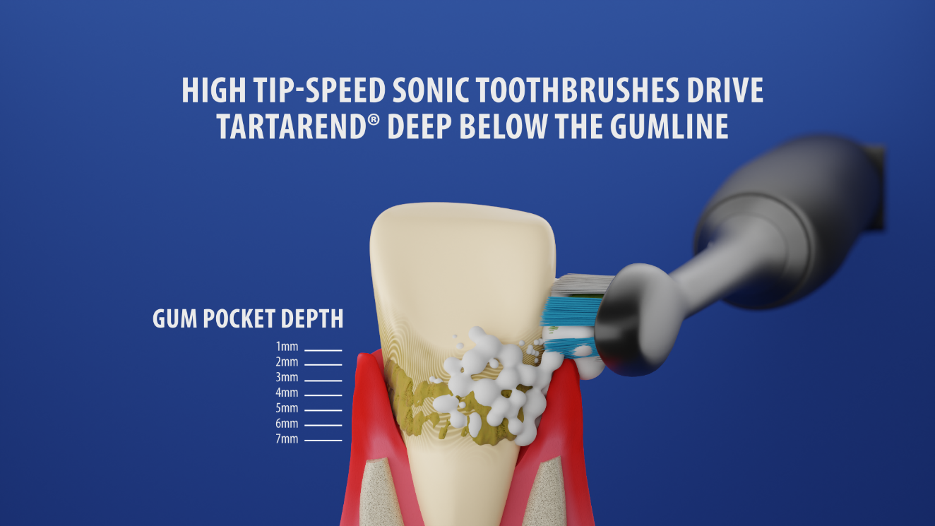 TartarEnd® Toothpaste The Ultimate Solution for Tartar Removal